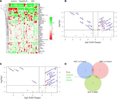 Urea as a By-Product of Ammonia Metabolism Can Be a Potential Serum Biomarker of Hepatocellular Carcinoma